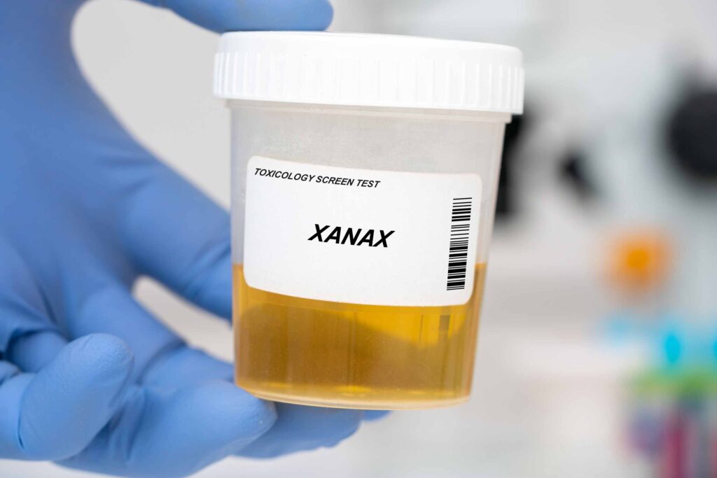 Certain medications, such as xanax, will show up in a urine drug screen test